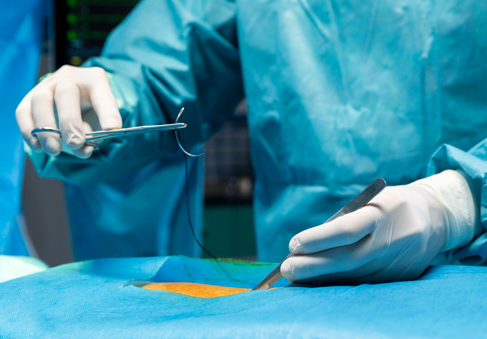 Шовный материал в хирургии: классификация, свойства и современные требования